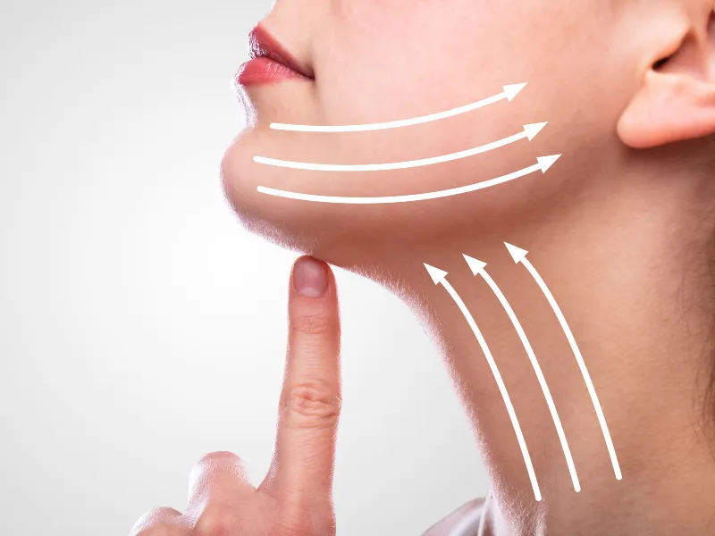 Face & Neck Lift
